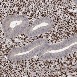 ZEB1 Antibody, Novus Biologicals 0.1mL; Unlabeled:Antibodies, Polyclonal