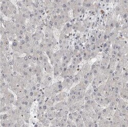 ZEB1 Antibody, Novus Biologicals 0.1mL; Unlabeled:Antibodies, Polyclonal