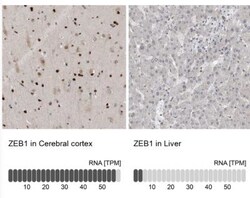 ZEB1 Antibody, Novus Biologicals 0.1mL; Unlabeled:Antibodies, Polyclonal