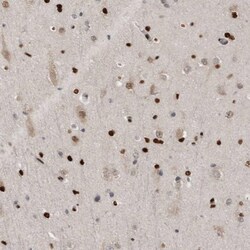 ZEB1 Antibody, Novus Biologicals 0.1mL; Unlabeled:Antibodies, Polyclonal