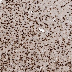 ZEB1 Antibody, Novus Biologicals 0.1mL; Unlabeled:Antibodies, Polyclonal