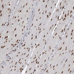 ZEB1 Antibody, Novus Biologicals 0.1mL; Unlabeled:Antibodies, Polyclonal