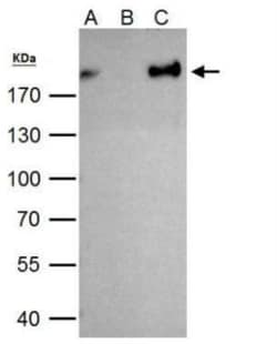 ZEB1 Antibody, Novus Biologicals 0.1mL; Unlabeled:Antibodies, Polyclonal
