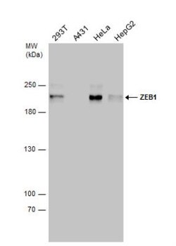 ZEB1 Antibody, Novus Biologicals 0.1mL; Unlabeled:Antibodies, Polyclonal