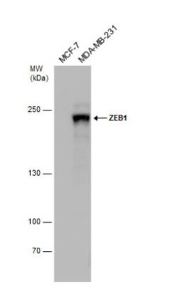 ZEB1 Antibody, Novus Biologicals 0.1mL; Unlabeled:Antibodies, Polyclonal