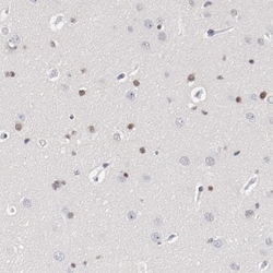 ZEB2 Antibody, Novus Biologicals 25 &mu;L; Unlabeled:Antibodies, Polyclonal
