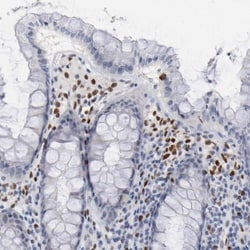 ZEB2 Antibody, Novus Biologicals 25 &mu;L; Unlabeled:Antibodies, Polyclonal