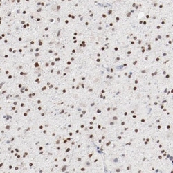 ZEB2 Antibody, Novus Biologicals 25 &mu;L; Unlabeled:Antibodies, Polyclonal