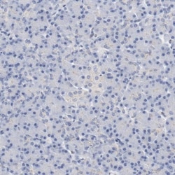 ZEB2 Antibody, Novus Biologicals 25 &mu;L; Unlabeled:Antibodies, Polyclonal
