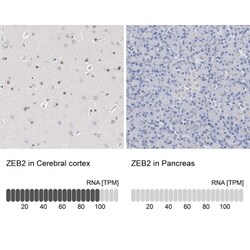 ZEB2 Antibody, Novus Biologicals 25 &mu;L; Unlabeled:Antibodies, Polyclonal