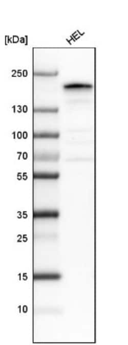 ZEB2 Antibody, Novus Biologicals 25 &mu;L; Unlabeled:Antibodies, Polyclonal