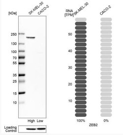 ZEB2 Antibody, Novus Biologicals 25 &mu;L; Unlabeled:Antibodies, Polyclonal