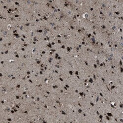 ZFAND2A Antibody, Novus Biologicals:Antibodies:Primary Antibodies