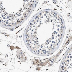 ZFAND3 Antibody, Novus Biologicals:Antibodies:Primary Antibodies
