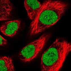 ZFHX4 Antibody, Novus Biologicals 0.1mL; Unlabeled:Antibodies, Polyclonal