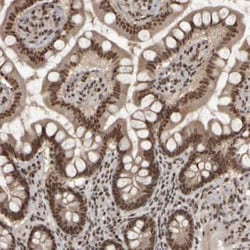 ZFHX4 Antibody, Novus Biologicals 0.1mL; Unlabeled:Antibodies, Polyclonal