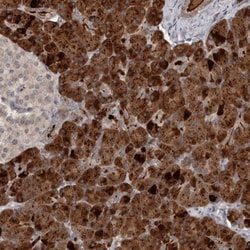 ZFP14 Antibody, Novus Biologicals 0.1mL; Unlabeled:Antibodies, Polyclonal