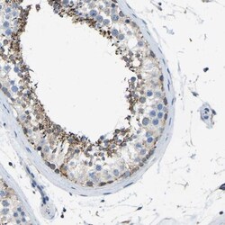 ZFP200 Antibody, Novus Biologicals:Antibodies:Primary Antibodies