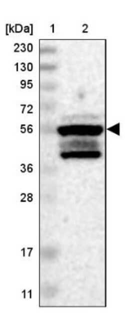ZFP200 Antibody, Novus Biologicals:Antibodies:Primary Antibodies