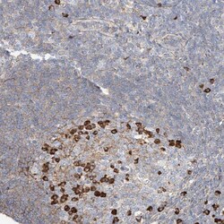 ZFP30 Antibody, Novus Biologicals:Antibodies:Primary Antibodies