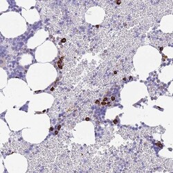 ZFP62 Antibody, Novus Biologicals 25 &mu;L, Unlabeled:Antibodies, Polyclonal