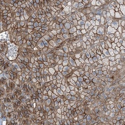 ZFP90 Antibody, Novus Biologicals:Antibodies:Primary Antibodies
