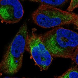 ZFP95 Antibody, Novus Biologicals 0.1mL; Unlabeled:Antibodies, Polyclonal