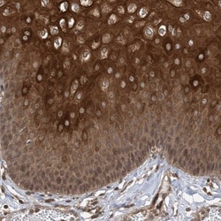 ZFP95 Antibody, Novus Biologicals 0.1mL; Unlabeled:Antibodies, Polyclonal