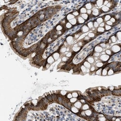 ZFPL1 Antibody, Novus Biologicals 0.1mL; Unlabeled:Antibodies, Polyclonal