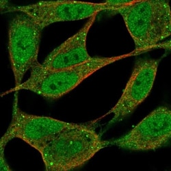 ZFPM1 Antibody, Novus Biologicals:Antibodies:Primary Antibodies