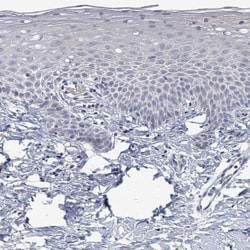 ZFPM1 Antibody, Novus Biologicals:Antibodies:Primary Antibodies