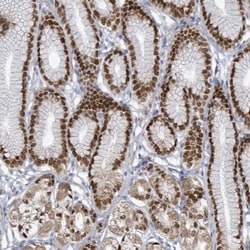 ZFPM1 Antibody, Novus Biologicals:Antibodies:Primary Antibodies