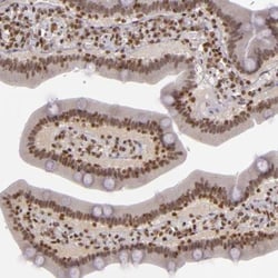 ZFX Antibody, Novus Biologicals:Antibodies:Primary Antibodies