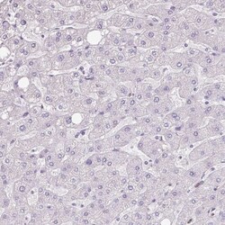 ZG16 Antibody, Novus Biologicals 25ul | Buy Online | Novus Biologicals | Fisher Scientific