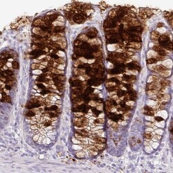 ZG16 Antibody, Novus Biologicals 25ul | Buy Online | Novus Biologicals | Fisher Scientific