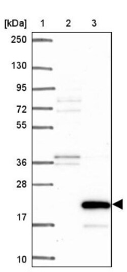 ZG16 Antibody, Novus Biologicals 25ul | Buy Online | Novus Biologicals | Fisher Scientific