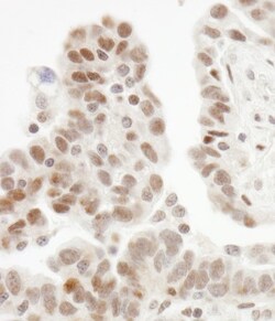 ZHX1 Antibody, Novus Biologicals 0.1mL; Unlabeled:Antibodies, Polyclonal