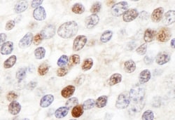 ZHX3 Antibody, Novus Biologicals 0.1mg; Unlabeled:Antibodies, Polyclonal