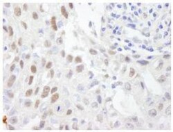 ZHX3 Antibody, Novus Biologicals 0.1mL; Unlabeled:Antibodies, Polyclonal