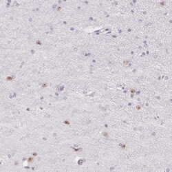 ZIC4 Antibody, Novus Biologicals:Antibodies:Primary Antibodies
