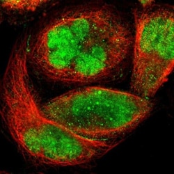 ZKSCAN1 Antibody, Novus Biologicals 25 &mu;L; Unlabeled:Antibodies, Polyclonal
