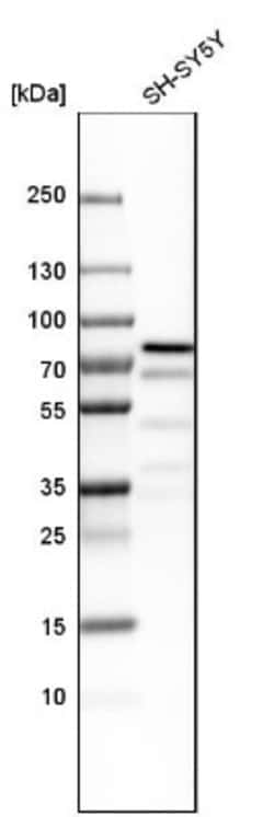 ZKSCAN1 Antibody, Novus Biologicals 25 &mu;L; Unlabeled:Antibodies, Polyclonal