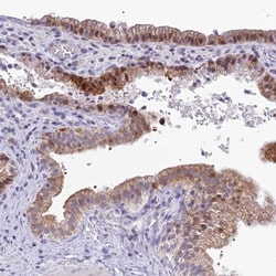 ZMIZ1/Zimp10 Antibody, Novus Biologicals:Antibodies:Primary Antibodies