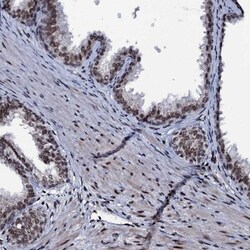 ZMIZ2 Antibody, Novus Biologicals 25 &mu;L; Unlabeled:Antibodies, Polyclonal