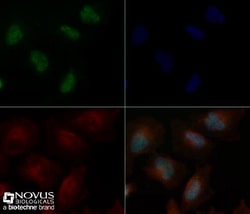 ZNF10 Antibody - BSA Free, Novus Biologicals:Antibodies:Primary Antibodies
