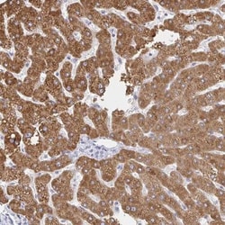 ZNF100 Antibody, Novus Biologicals 25 &mu;L, Unlabeled:Antibodies, Polyclonal