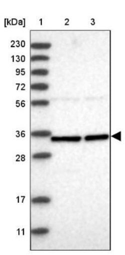ZNF124 Antibody, Novus Biologicals 25 &mu;L; Unlabeled:Antibodies, Polyclonal