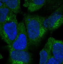 ZNF135 Antibody, Novus Biologicals 0.1mL; Unlabeled:Antibodies, Polyclonal