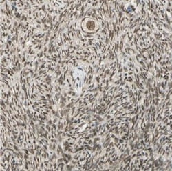 ZNF135 Antibody, Novus Biologicals 0.1mL; Unlabeled:Antibodies, Polyclonal
