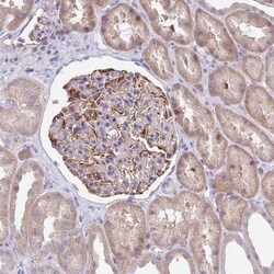 ZNF14 Antibody, Novus Biologicals 25 &mu;L, Unlabeled:Antibodies, Polyclonal